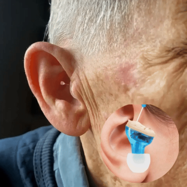 ๐ก๐ข๐๐๐ฉ๐๐ง๐๐โข CIC Rechargeable Hearing Aids