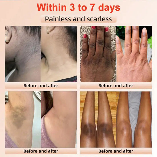 🔥Purifying Enzymes Exfoliating Gel