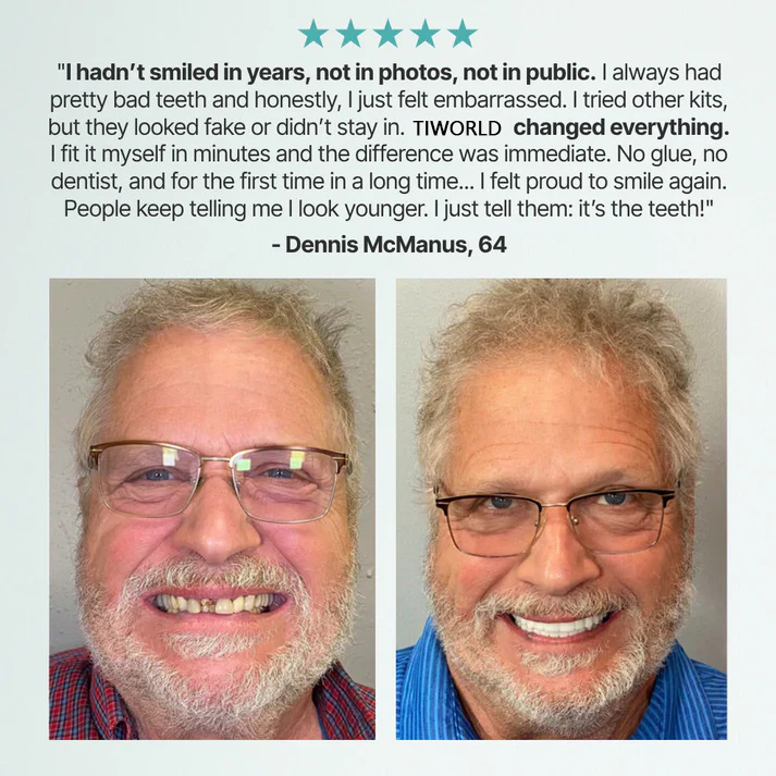 🎅CHRISTMAS HOT SALE-🏆Ends Today: 70% OFF! 🦷 Tiworld™ Custom-Fit Fully Functional Dentures for a More Confident Smile!