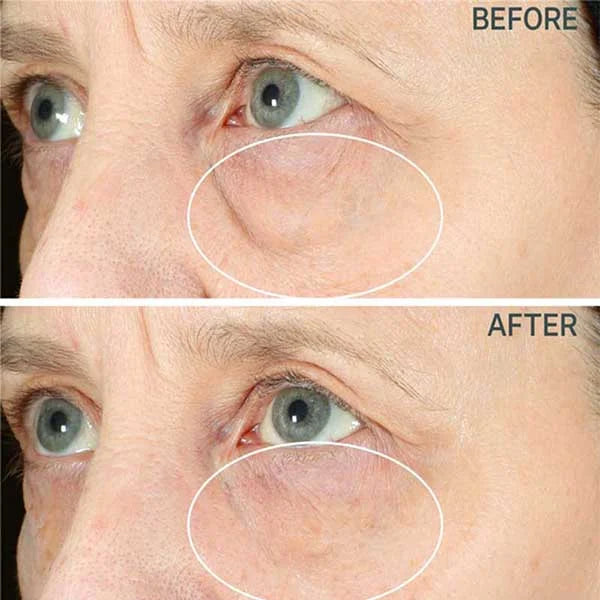 💖BUY 1 GET 1 FREE💖Metacell Renewal Peptide Eye Cream