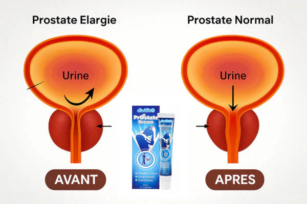 Natural Anti-Prostate Cream - Reduces inflammation, eliminates urinary problems, strengthens and restores confidence in men
