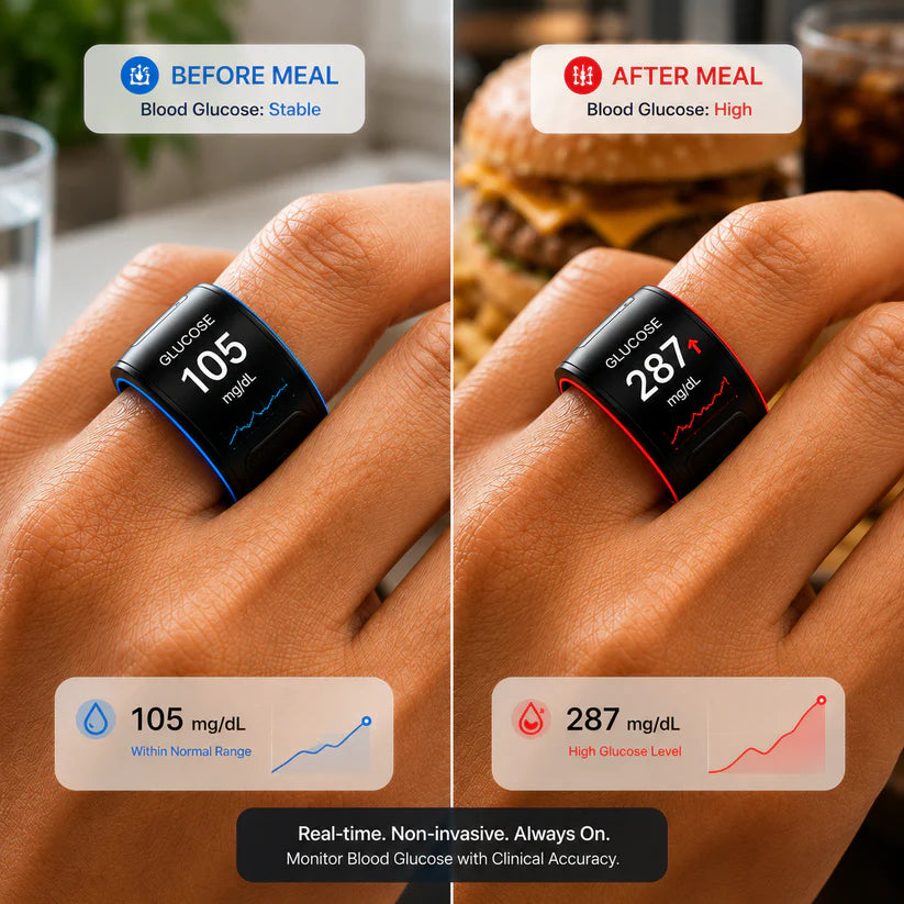 Pryxo™ G1 Non-Invasive Smart Ring