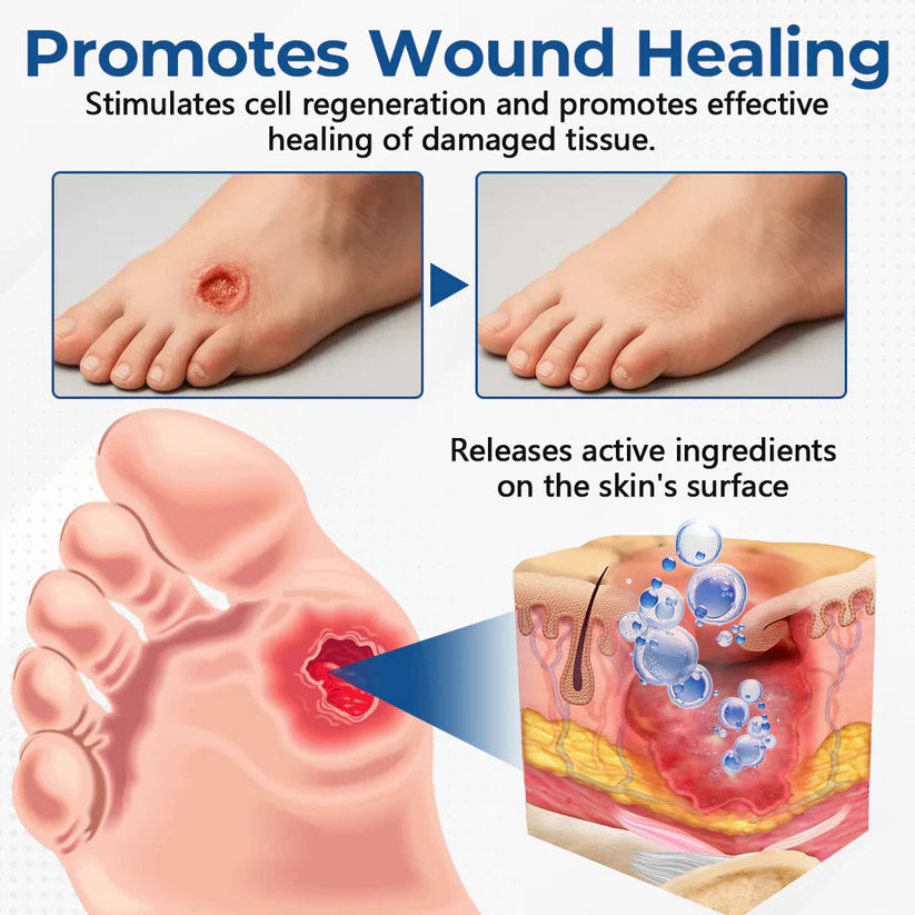 Ceoerty® PureFoot Diabetes Treatment Stick