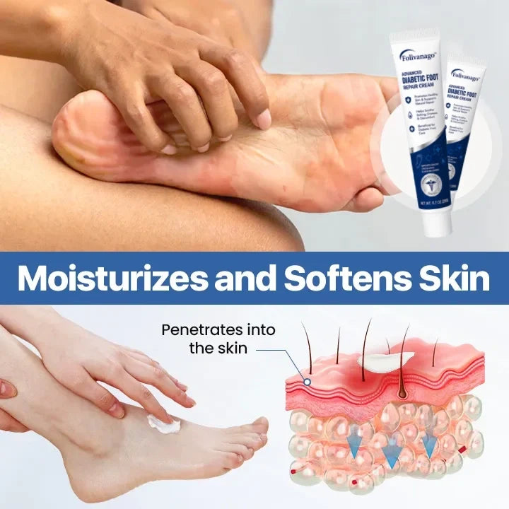 AnnieCare® VitaGluco Diabetes Treatment Cream -👨‍⚕️ American Academy of Dermatology (AAD) Approved