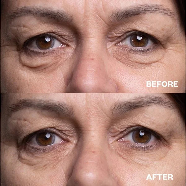 💖BUY 1 GET 1 FREE💖Metacell Renewal Peptide Eye Cream
