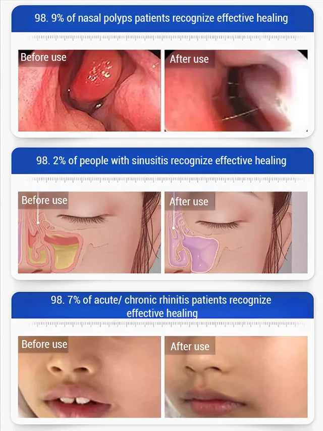 Nasal care spray🌿