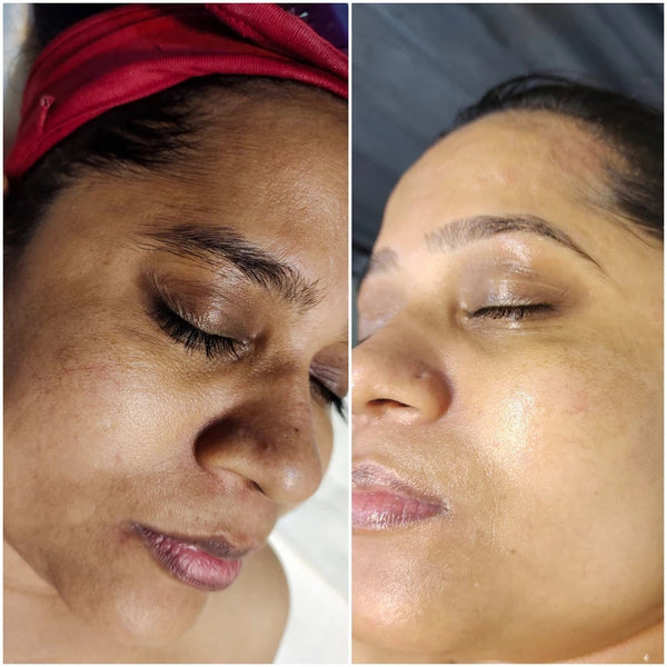 🔥Fast Dark Spot Remover-AQA™ Melanin Correcting Brightening Serum