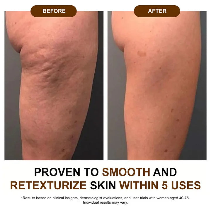 QIAWI® Silk Body Oil-Deep Hydration & Firming for Dry Skin
