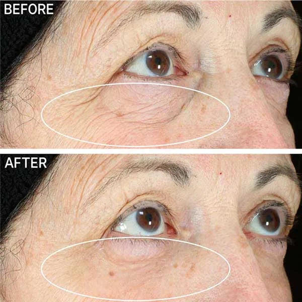 💖BUY 1 GET 1 FREE💖Metacell Renewal Peptide Eye Cream